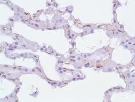 Immunohistochemistry (Formalin/PFA-fixed paraffin-embedded sections) - Anti-Nestin antibody [SP103] - Neural Stem Cell Marker (AB105389)
