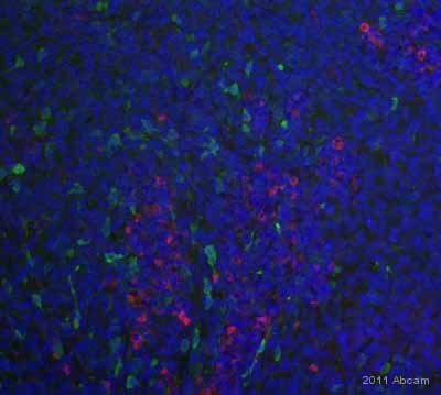 Immunohistochemistry (Formalin/PFA-fixed paraffin-embedded sections) - Anti-Nestin antibody [SP103] (ab105389), expandable thumbnail