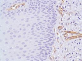Immunohistochemistry (Formalin/PFA-fixed paraffin-embedded sections) - Anti-Nestin antibody [SP103] (ab105389), expandable thumbnail