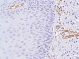Immunohistochemistry (Formalin/PFA-fixed paraffin-embedded sections) - Anti-Nestin antibody [SP103] - Neural Stem Cell Marker (AB105389)