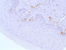 Immunohistochemistry (Formalin/PFA-fixed paraffin-embedded sections) - Anti-Nestin antibody [SP103] (ab105389), expandable thumbnail