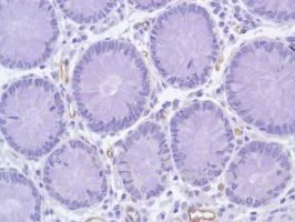 Immunohistochemistry (Formalin/PFA-fixed paraffin-embedded sections) - Anti-Nestin antibody [SP103] - Neural Stem Cell Marker (AB105389)