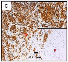 Immunohistochemistry (Formalin/PFA-fixed paraffin-embedded sections) - Anti-Nestin antibody [SP103] (AB105389), expandable thumbnail