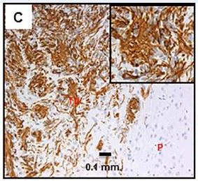 Immunohistochemistry (Formalin/PFA-fixed paraffin-embedded sections) - Anti-Nestin antibody [SP103] - Neural Stem Cell Marker (AB105389)