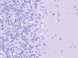 Immunohistochemistry (Formalin/PFA-fixed paraffin-embedded sections) - Anti-Nestin antibody [SP103] (ab105389), expandable thumbnail
