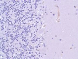 Immunohistochemistry (Formalin/PFA-fixed paraffin-embedded sections) - Anti-Nestin antibody [SP103] - Neural Stem Cell Marker (AB105389)