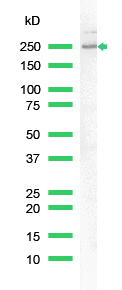 Western blot - Anti-Nestin antibody [SP103] - Neural Stem Cell Marker (ab105389), expandable thumbnail