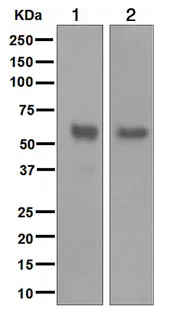 Western blot - Anti-NETO2 antibody [EPR3497] (AB109288)
