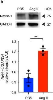 Anti-Netrin 1 antibody [EPR5428] (ab126729) | Abcam