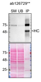 Immunoprecipitation - Anti-Netrin 1 antibody [EPR5428] - BSA and Azide free (AB201324), expandable thumbnail