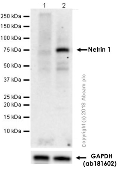 Western blot - Anti-Netrin 1 antibody [EPR5428] - BSA and Azide free (AB201324), expandable thumbnail