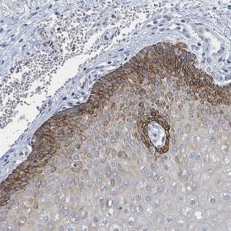 Immunohistochemistry (Formalin/PFA-fixed paraffin-embedded sections) - Anti-Netrin-3 antibody (AB185200)