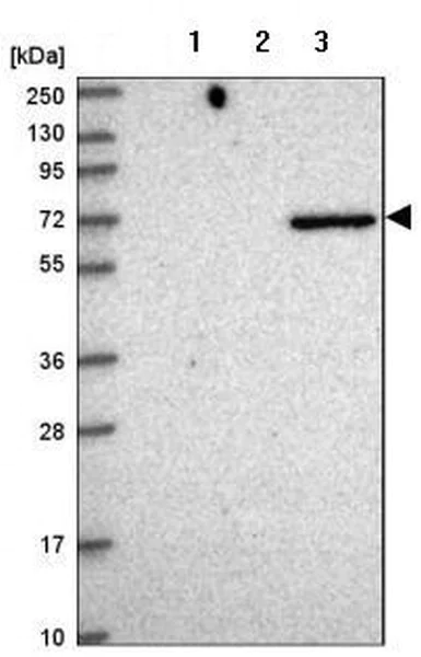Western blot - Anti-Netrin-3 antibody (AB185200)