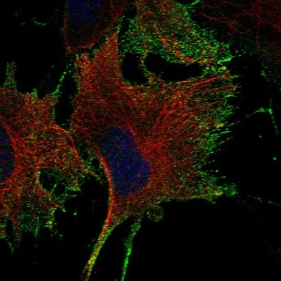 Immunocytochemistry/ Immunofluorescence - Anti-Netrin G1 antibody (AB221456)