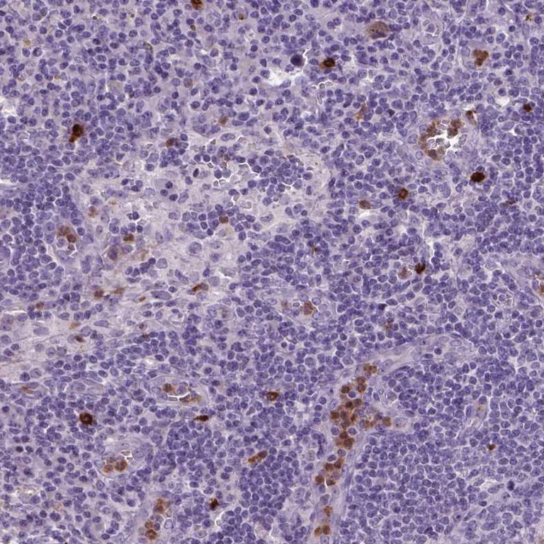 Immunohistochemistry (Formalin/PFA-fixed paraffin-embedded sections) - Anti-Netrin G2 antibody (AB254986)