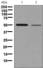 Western blot - Anti-Netrin G2 antibody [EPR4570(2)] - BSA and Azide free (AB248632)