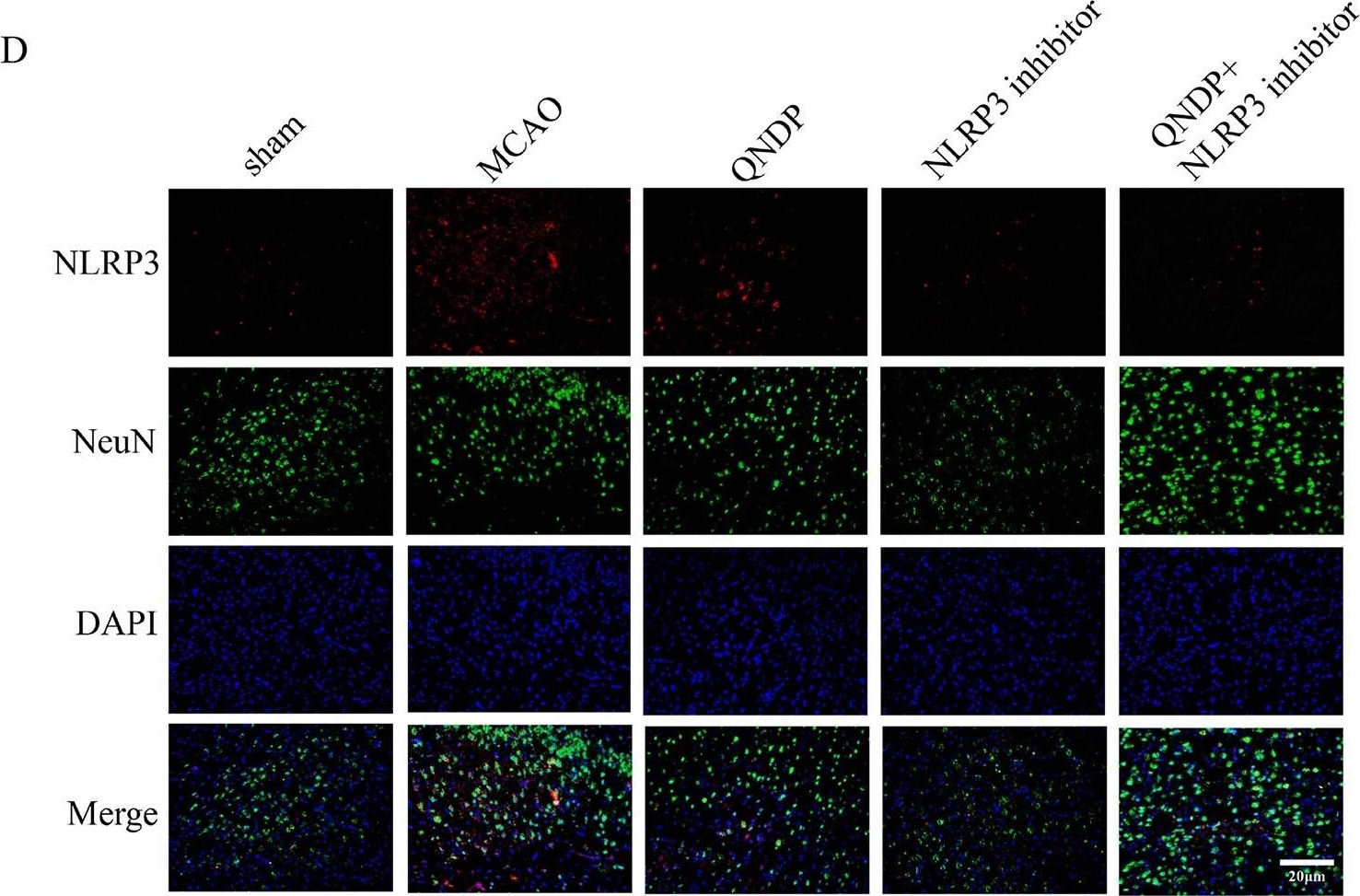 Immunocytochemistry/ Immunofluorescence - Anti-NeuN antibody [1B7] - Neuronal Marker (ab104224), expandable thumbnail