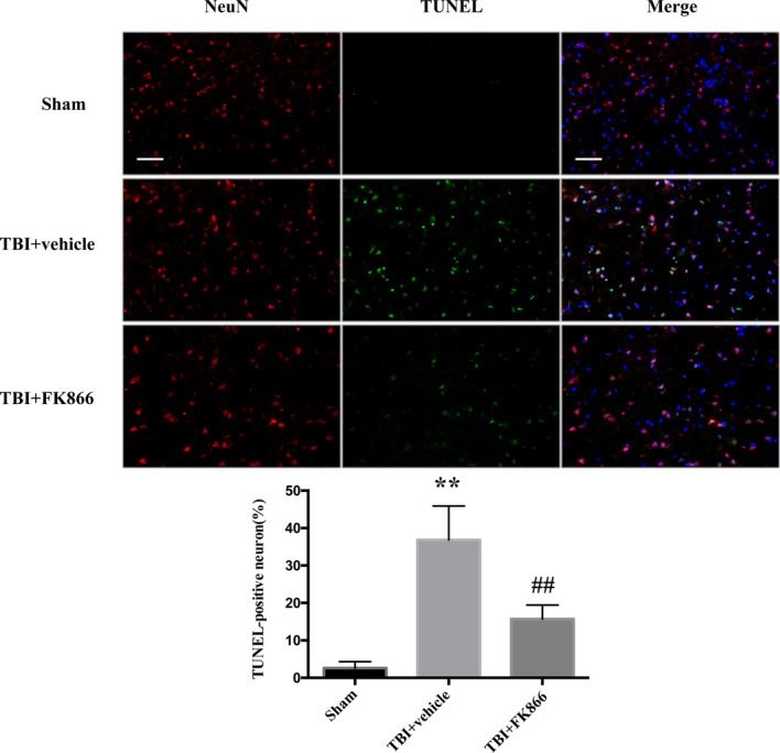 Immunocytochemistry/ Immunofluorescence - Anti-NeuN antibody [1B7] - Neuronal Marker (ab104224), expandable thumbnail