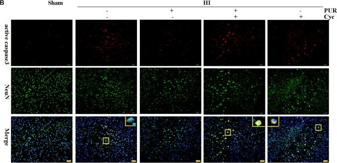 Immunohistochemistry - Anti-NeuN antibody [1B7] - Neuronal Marker (ab104224), expandable thumbnail