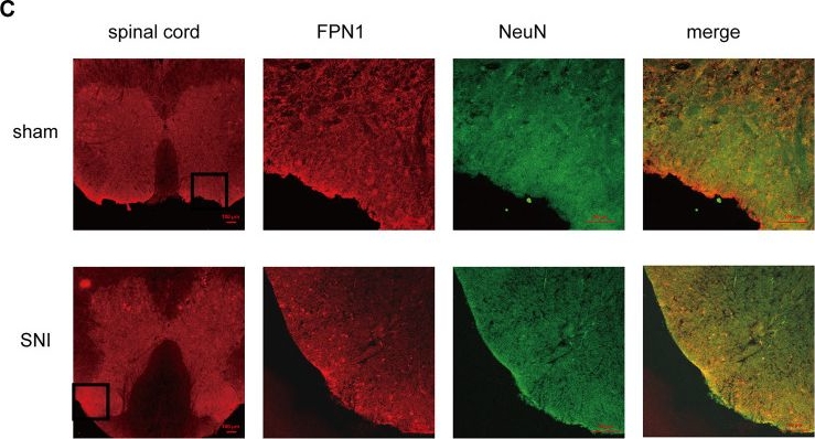 Immunohistochemistry - Anti-NeuN antibody [1B7] - Neuronal Marker (ab104224), expandable thumbnail
