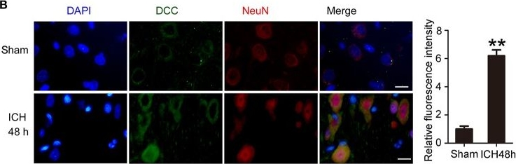 Western blot - Anti-NeuN antibody [1B7] - Neuronal Marker (ab104224), expandable thumbnail
