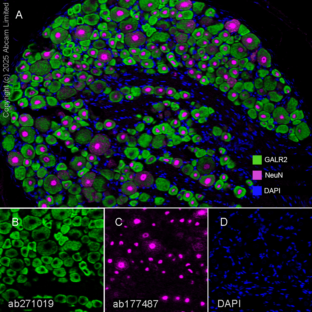 Anti-NeuN antibody [EPR12763] - Carrier free (ab209898) | Abcam
