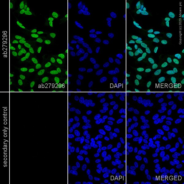 Immunocytochemistry - Anti-NeuN antibody [EPR12763] - Mouse IgG2a (Chimeric) (AB279296), expandable thumbnail