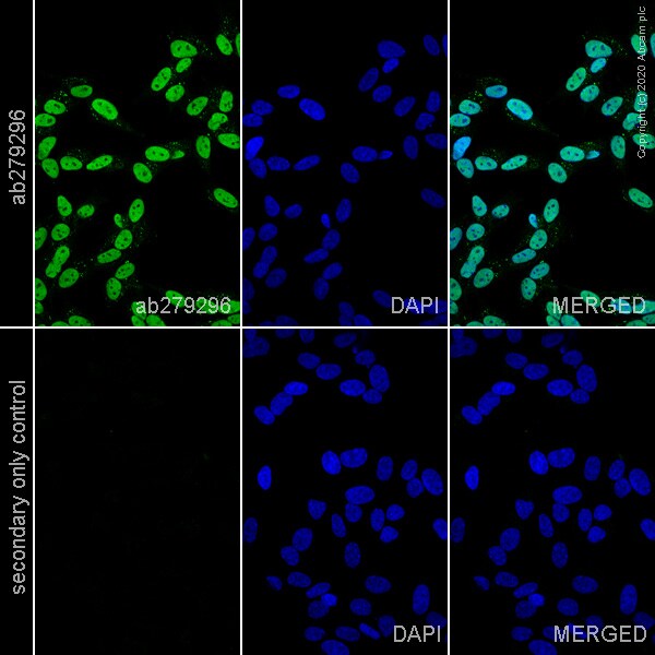 Immunocytochemistry - Anti-NeuN antibody [EPR12763] - Mouse IgG2a (Chimeric) (AB279296), expandable thumbnail
