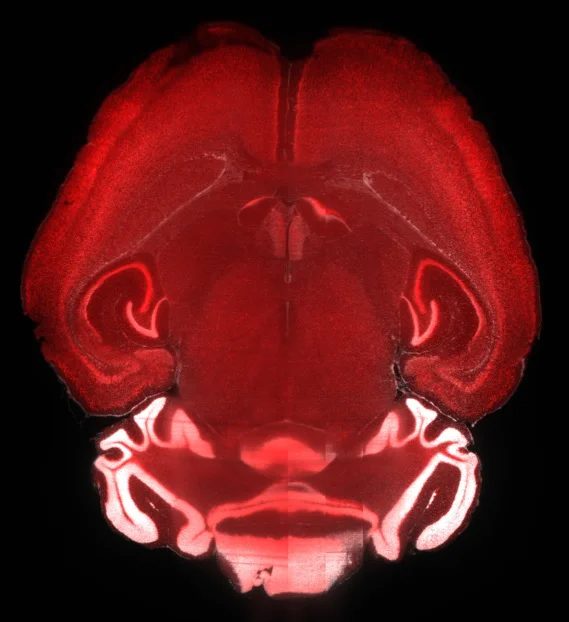 IHC-tissue clearing - Anti-NeuN antibody [EPR12763] - Neuronal Marker (AB177487)
