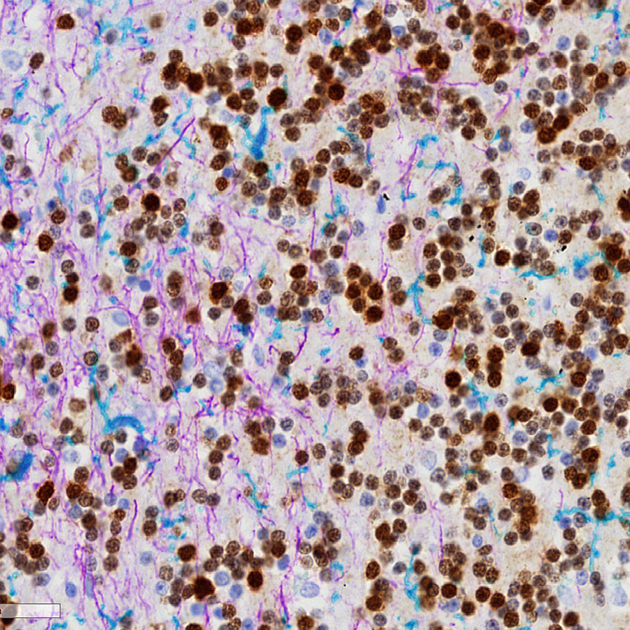 Multiplex immunohistochemistry - Anti-NeuN antibody [EPR12763] - Neuronal Marker (ab177487), expandable thumbnail