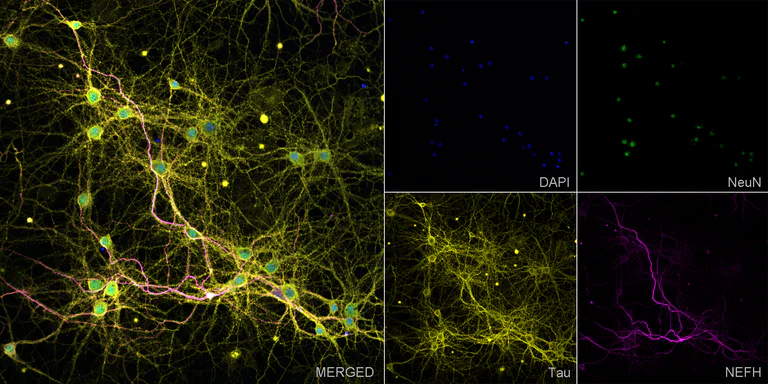 Immunocytochemistry/ Immunofluorescence - Anti-NeuN antibody [EPR12763] - Neuronal Marker - Rat IgG2a (Chimeric) (AB279297)
