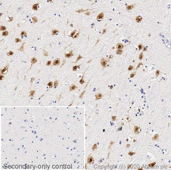 neun-antibody-epr12763-