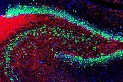 Immunohistochemistry (Formalin/PFA-fixed paraffin-embedded sections) - Anti-NeuN antibody - Neuronal Marker (AB104225), expandable thumbnail