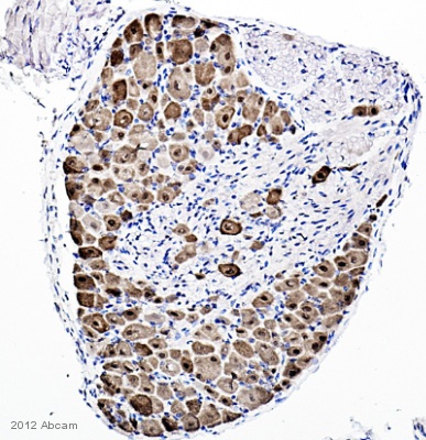 Immunohistochemistry (Formalin/PFA-fixed paraffin-embedded sections) - Anti-NeuN antibody - Neuronal Marker (ab104225), expandable thumbnail