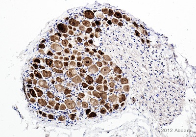 Immunohistochemistry (Formalin/PFA-fixed paraffin-embedded sections) - Anti-NeuN antibody - Neuronal Marker (ab104225), expandable thumbnail