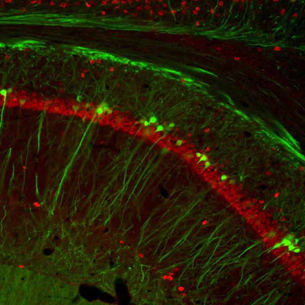 Immunohistochemistry (Formalin/PFA-fixed paraffin-embedded sections) - Anti-NeuN antibody - Neuronal Marker (AB134014)