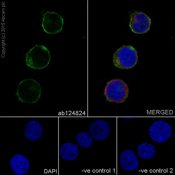 Immunocytochemistry/ Immunofluorescence - Neural Progenitor Cell Marker (CXCR4, Nestin, PDGFR, SOX2, Vimentin, Doublecortin) Antibody Panel (AB263461), expandable thumbnail
