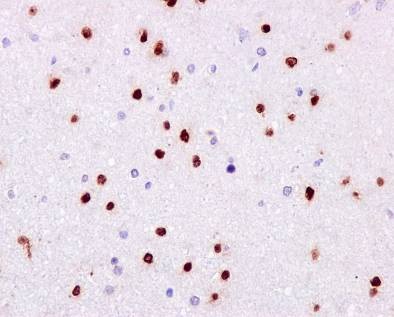 Immunohistochemistry (Formalin/PFA-fixed paraffin-embedded sections) - Neural Progenitor Cell Marker (CXCR4, Nestin, PDGFR, SOX2, Vimentin, Doublecortin) Antibody Panel (AB263461), expandable thumbnail