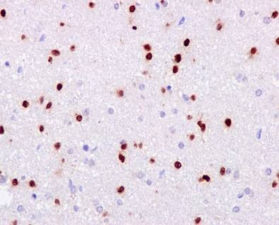 Immunohistochemistry (Formalin/PFA-fixed paraffin-embedded sections) - Neural Stem Cell Marker (Nestin, SOX2, Occludin, E Cadherin, Hes1, Notch1) Antibody Panel - Human (ab254027), expandable thumbnail