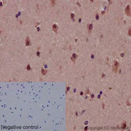 Immunohistochemistry (Formalin/PFA-fixed paraffin-embedded sections) - Neural Stem Cell Marker (Nestin, SOX2, Occludin, E Cadherin, Hes1, Notch1) Antibody Panel - Human (AB254027)