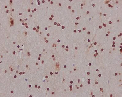 Immunohistochemistry (Formalin/PFA-fixed paraffin-embedded sections) - Neural Stem Cell Marker (Nestin, SOX2, Occludin, E Cadherin, Hes1, Notch1) Antibody Panel - Human (AB254027)