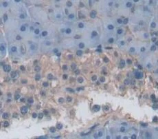 Immunohistochemistry (Formalin/PFA-fixed paraffin-embedded sections) - Anti-Neuraminidase antibody (AB233119)