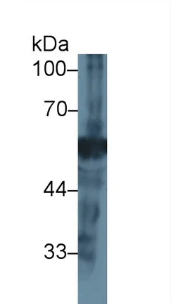 Western blot - Anti-Neuraminidase antibody (AB233119)