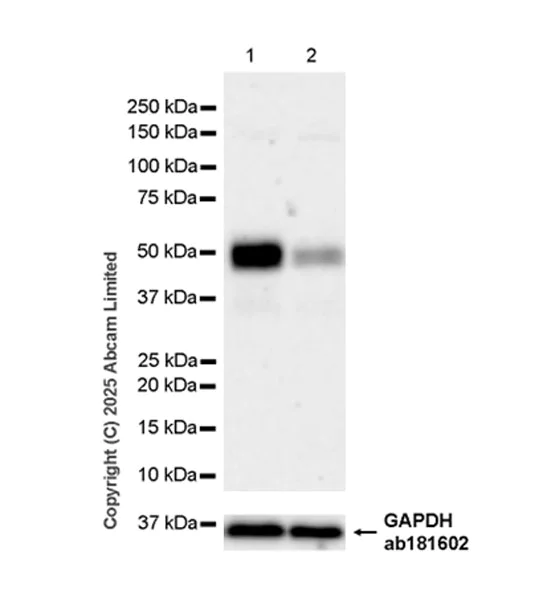 Western blot - Anti-Neuraminidase antibody [EPR27208-35] (AB325389)