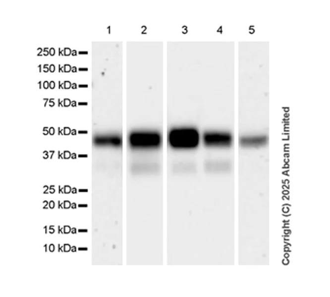 Western blot - Anti-Neuraminidase antibody [EPR27208-35] (AB325389)