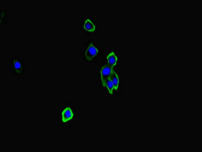 Immunocytochemistry/ Immunofluorescence - Anti-Neurexin I beta antibody (AB222806)
