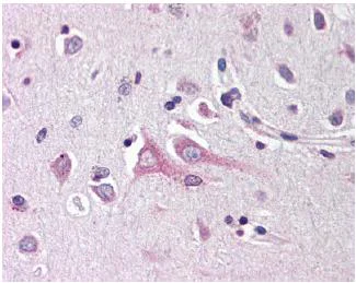 Immunohistochemistry (Formalin/PFA-fixed paraffin-embedded sections) - Anti-Neuritin antibody (AB64186)