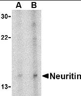 Western blot - Anti-Neuritin antibody (AB64186)