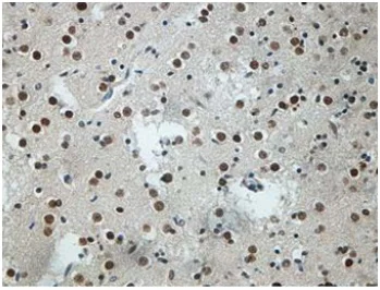 Immunohistochemistry (Formalin/PFA-fixed paraffin-embedded sections) - Anti-Neuro D4 antibody - C-terminal (AB199299)