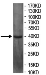 Western blot - Anti-Neuro D4 antibody - C-terminal (AB199299)